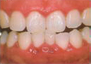 歯周病治療 三浦歯科